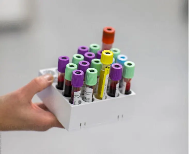 Blood Sampling Service