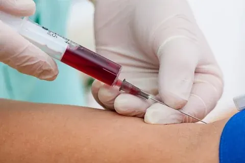 Arterial Blood Gas (ABG) Test